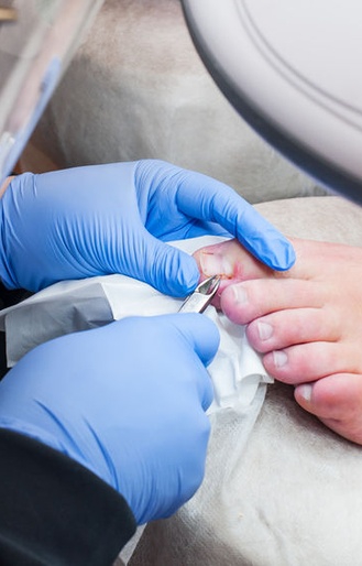 Medical Pedicure
